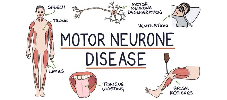 motor neuron