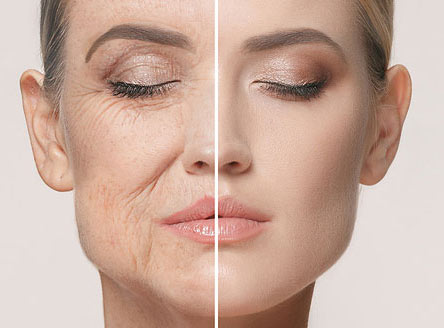 anti-aging-in-treatment