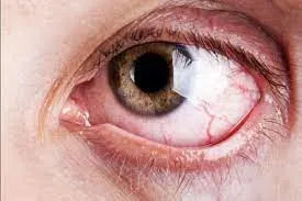 Stem Cell Treatment for Retinitis Pigmentosa Disease